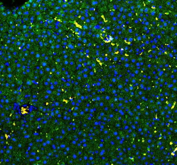 Anti-GSTA1/GSTA2/GSTA3/GSTA4/GSTA5 Antibody