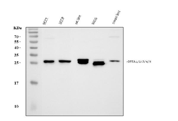 Anti-GSTA1/GSTA2/GSTA3/GSTA4/GSTA5 Antibody