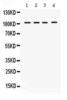 HDAC7 Rabbit Polyclonal Antibody