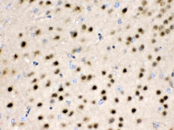 Anti-HDAC11 Antibody