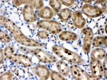 Anti-HINT1 Antibody