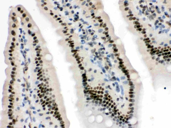 Anti-HMG4/HMGB3 Antibody