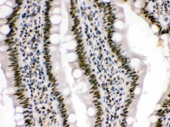 Anti-HMG4/HMGB3 Antibody