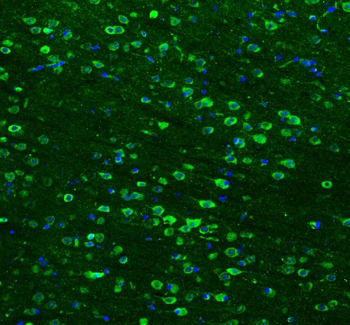 Anti-Hsp90 beta/HSP90AB1 Antibody