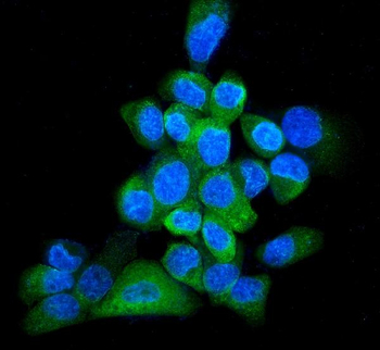 Anti-GRP94/HSP90B1 Antibody