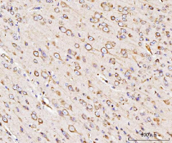 Anti-GRP94/HSP90B1 Antibody