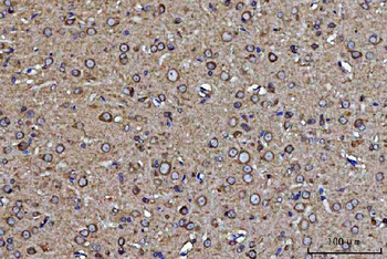 Anti-GRP94/HSP90B1 Antibody