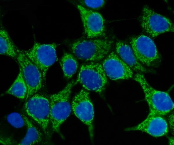 Anti-Hsp70/HSPA1A/HSPA1B Antibody