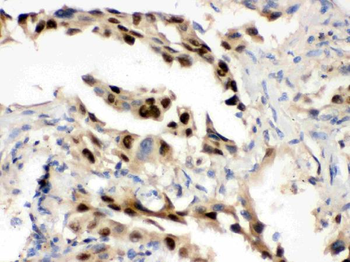 Anti-Hsp70/HSPA1A/HSPA1B Antibody