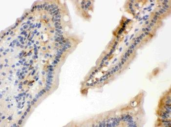 Anti-Hsp70/HSPA1A/HSPA1B Antibody