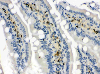 Anti-Hsp70/HSPA1A/HSPA1B Antibody