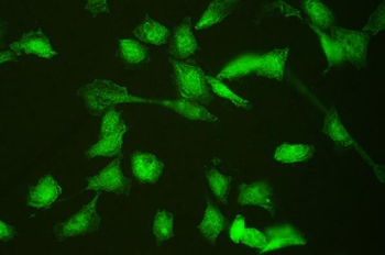 Anti-HSPA2 Antibody