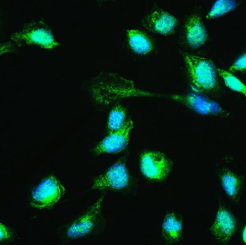 Anti-HSPA2 Antibody