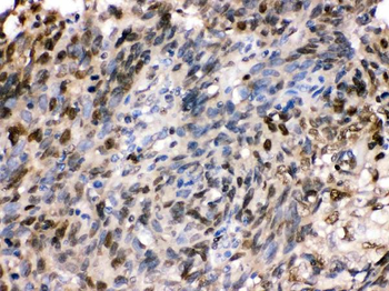 HSPA2 Antibody