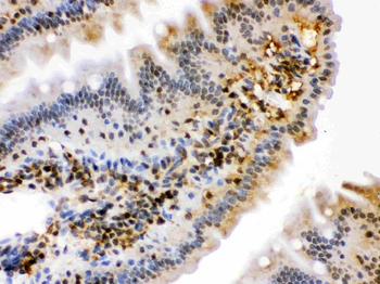 Anti-HSPA2 Antibody