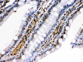 Anti-HSPA2 Antibody