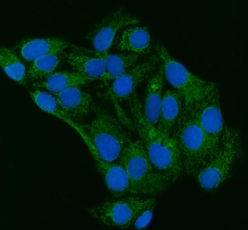Anti-Grp75/HSPA9 Antibody