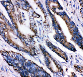 Anti-Grp75/HSPA9 Antibody