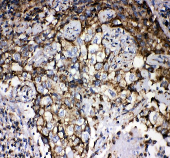 Anti-Grp75/HSPA9 Antibody
