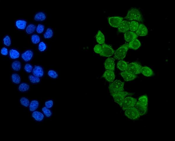 Anti-Ikaros/IKZF1 Antibody