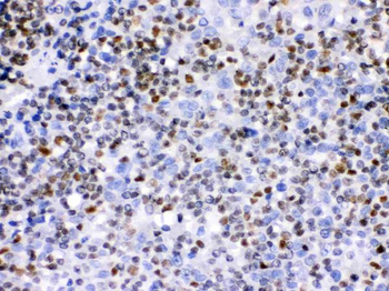 Anti-Ikaros/IKZF1 Antibody