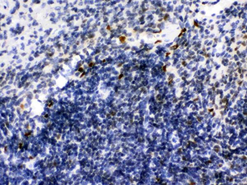 Anti-Ikaros/IKZF1 Antibody