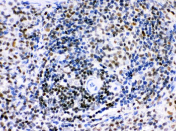 Anti-Ikaros/IKZF1 Antibody