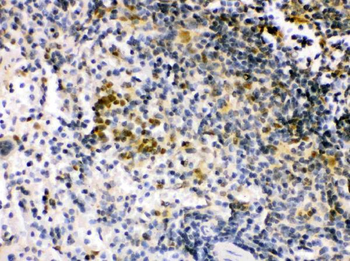 Anti-IRF5 Antibody