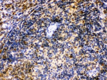 Anti-IRF5 Antibody