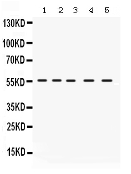 Anti-IRF5 Antibody