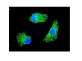 KChIP2/KCNIP2 Antibody
