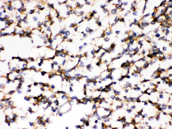 Anti-KChIP2/KCNIP2 Antibody