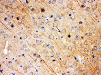 Anti-KChIP2/KCNIP2 Antibody