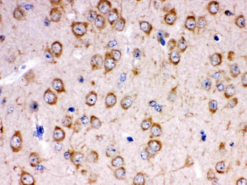 Anti-KChIP2/KCNIP2 Antibody