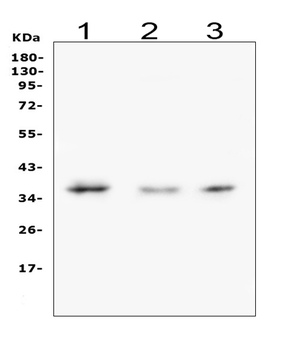 Galectin 8/LGALS8 Antibody