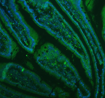 Anti-Lysozyme/LYZ Antibody
