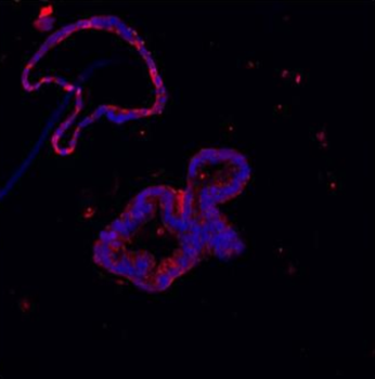 Anti-Lysozyme/LYZ Antibody