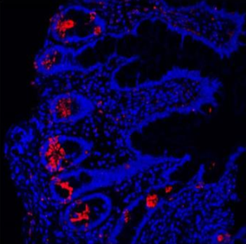 Anti-Lysozyme/LYZ Antibody