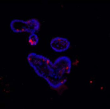 Anti-Lysozyme/LYZ Antibody