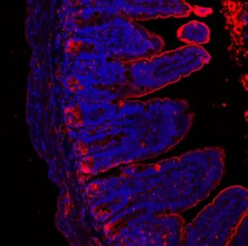 Anti-Lysozyme/LYZ Antibody