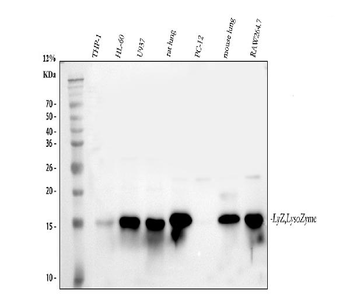 Anti-Lysozyme/LYZ Antibody