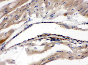 Anti-Monoamine Oxidase A/MAOA Antibody