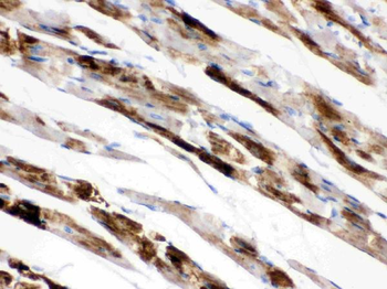 Anti-Monoamine Oxidase A/MAOA Antibody