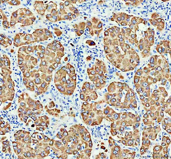 Anti-Monoamine Oxidase B/MAOB Antibody