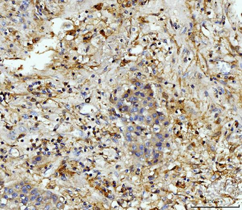 Anti-MMP9 Antibody