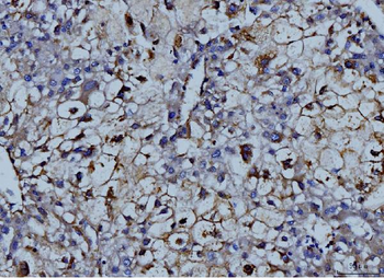 Anti-MMP9 Antibody