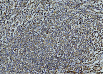 Anti-MMP9 Antibody