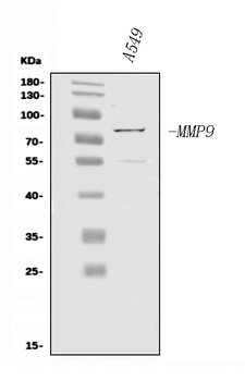 Anti-MMP9 Antibody