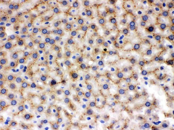 Anti-MMP9 Antibody