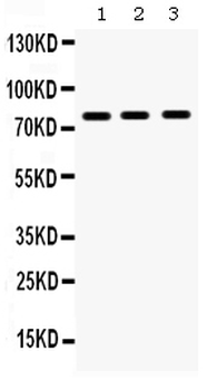 Anti-MMP9 Antibody